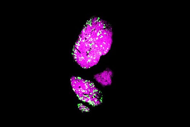 Anestésicos con terapias luminosas