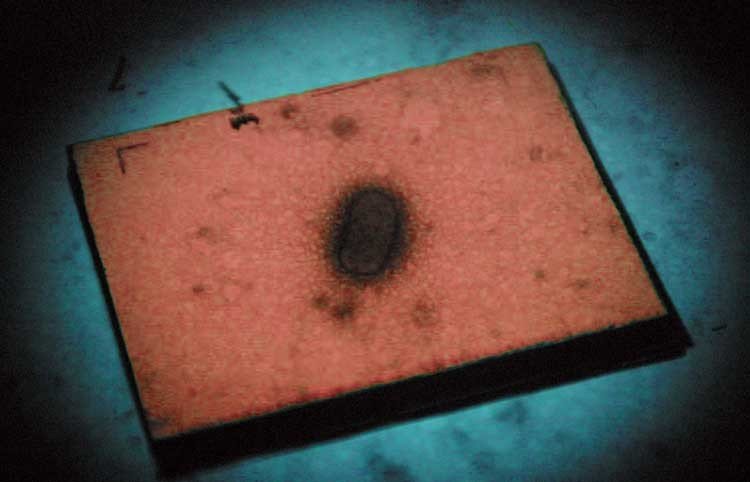 microorganismos