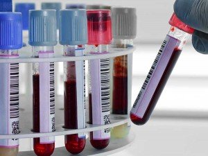 análisis de Sangre