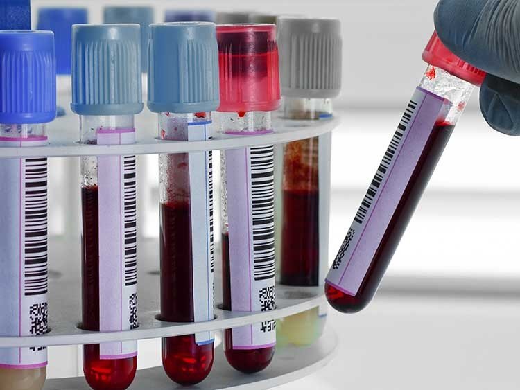 análisis de Sangre