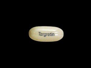 Fármaco aprobado contra la aparición del Alzheimer