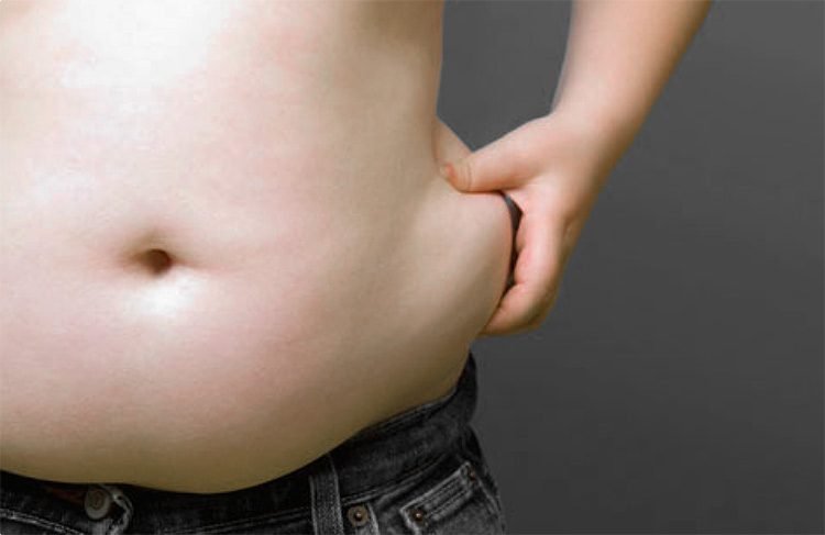 La obesidad aumenta la desnutrición en el mundo