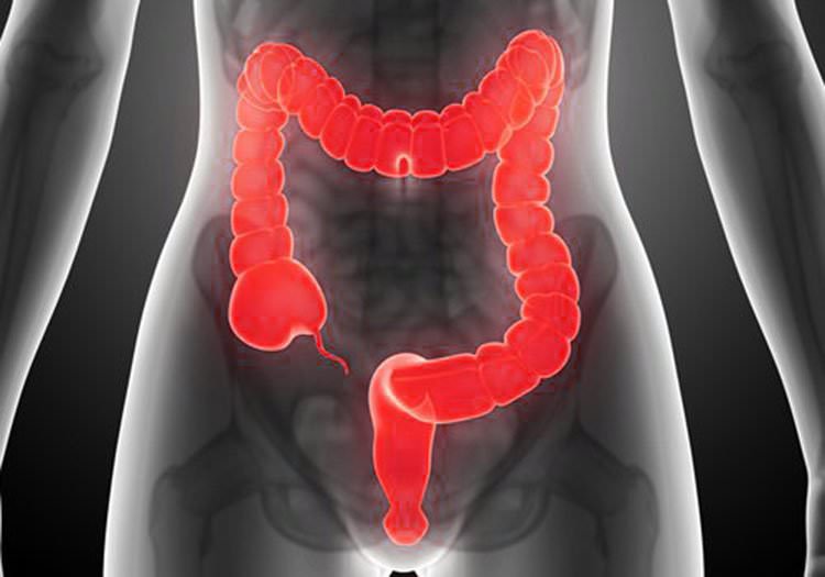 Dieta Detox para después de la hidroterapia de colon