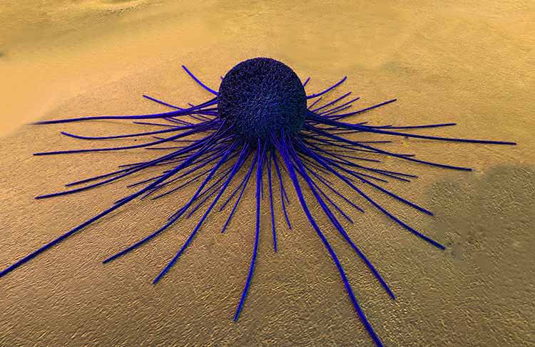 Cura fantástica del cáncer con metástasis