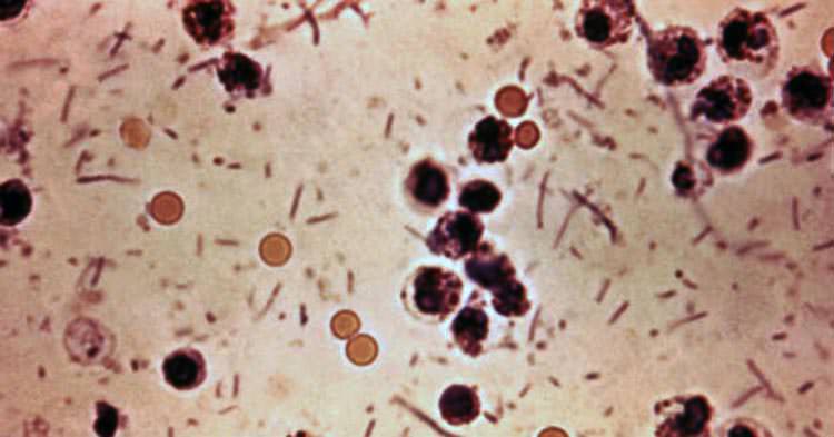 Urgen desarrollar medicamentos contra bacterias asesinas