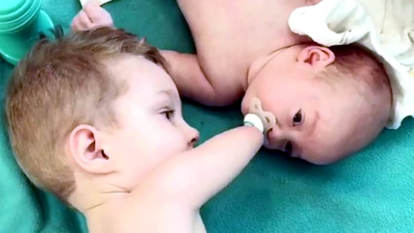 Bebé sin brazos le da el chupete a su hermanito