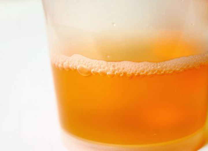 Micción Frecuente – mal olor de la orina – causas
