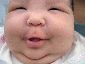Bebé gordito: cuidado con la epidemia de obesidad