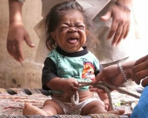 Con 23 años está atrapado en un cuerpo de bebé